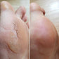 Mila Smooth™ 3 Pro – Vos pieds lisses en 5 minutes chrono